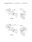 ANCHORING AN INTRAVENOUS CANNULA diagram and image