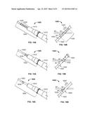 ANCHORING AN INTRAVENOUS CANNULA diagram and image