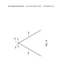 WOUND CLOSURE DEVICE diagram and image