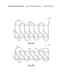 WOUND CLOSURE DEVICE diagram and image