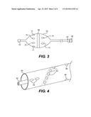 APPARATUS AND METHOD OF ASSESSING TRANSVASCULAR DENERVATION diagram and image