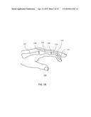 DEVICES FOR BONE FIXATION USING AN INTRAMEDULLARY FIXATION IMPLANT diagram and image