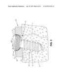 ANTI-UNSCREWING AND MULTI-ANGULAR FASTENING APPARATUSES AND METHODS FOR     SURGICAL BONE SCREW/PLATE SYSTEMS diagram and image