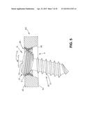 ANTI-UNSCREWING AND MULTI-ANGULAR FASTENING APPARATUSES AND METHODS FOR     SURGICAL BONE SCREW/PLATE SYSTEMS diagram and image