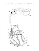 MEDICAL DEVICE LEAD ASSEMBLY HAVING INTEGRATED PRESSURE-RESISTING MEMBER diagram and image