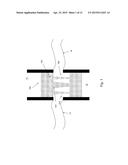 HEART VALVE PROSTHESIS WITH OPEN STENT diagram and image