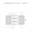 HEART VALVE PROSTHESIS WITH OPEN STENT diagram and image