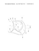 HEART VALVE PROSTHESIS WITH OPEN STENT diagram and image