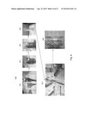 HEART VALVE PROSTHESIS WITH OPEN STENT diagram and image