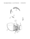 PRE-OPERATIVE SIMULATION OF TRANS-CATHETER VALVE IMPLANTATION diagram and image