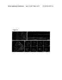 Nucleic Acid for Determining Actin Structures in Living Cells diagram and image