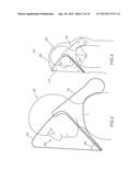 PROTECTIVE APPAREL AND SUPPORT APPARATUS AND METHOD OF USE diagram and image