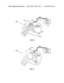 Manufacturing Process for a Custom Fit In-Ear Monitor Utilizing a Single     Piece Driver Module diagram and image