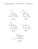 Manufacturing Process for a Custom Fit In-Ear Monitor Utilizing a Single     Piece Driver Module diagram and image