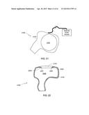 Manufacturing Process for a Custom Fit In-Ear Monitor Utilizing a Single     Piece Driver Module diagram and image