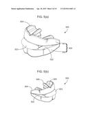 DENTAL APPLIANCE diagram and image