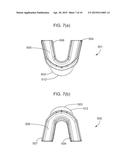 DENTAL APPLIANCE diagram and image