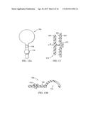 VALVES, DEVICES, AND METHODS FOR ENDOBRONCHIAL THERAPY diagram and image