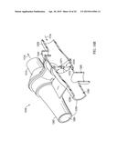 VALVES, DEVICES, AND METHODS FOR ENDOBRONCHIAL THERAPY diagram and image