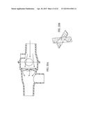 VALVES, DEVICES, AND METHODS FOR ENDOBRONCHIAL THERAPY diagram and image