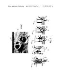 METHOD AND DEVICE FOR FITTING INSERTS BY BONDING BY WAY OF CONTROLLED     POLYMERIZATION diagram and image