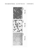 PROCESS FOR IN SITU UPGRADING OF A HEAVY HYDROCARBON USING ASPHALTENE     PRECIPITANT ADDITIVES diagram and image
