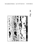 Osteosynthesis with nano-silver diagram and image