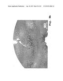 Osteosynthesis with nano-silver diagram and image