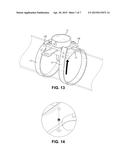 Spreader Attachment diagram and image