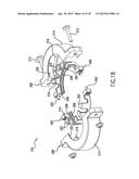 WASTE DISPOSAL SYSTEM WITH IMPROVED MOUNTING ASSEMBLY diagram and image