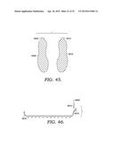 Automated Rubber Molding And De-Molding diagram and image