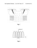 LENS ANTENNA WITH ELECTRONIC BEAM STEERING CAPABILITIES diagram and image