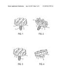 PLASTIC COMPONENT AND METHOD FOR PRODUCING A PLASTIC COMPONENT diagram and image