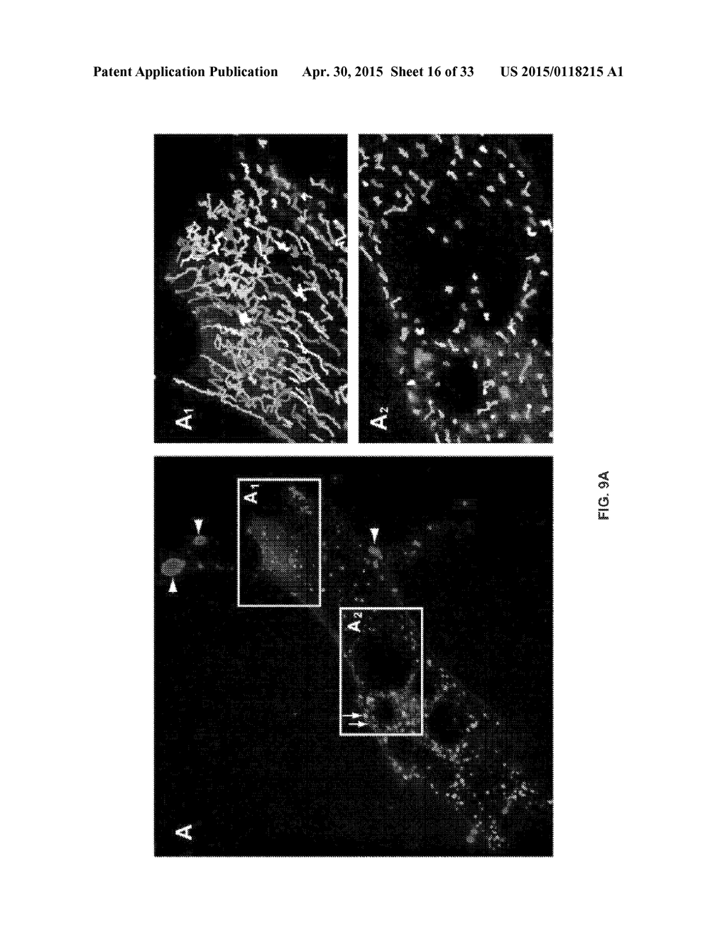 Methods of Inhibiting Cell Proliferation - diagram, schematic, and image 17