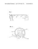 IONTOPHORETIC DEVICE AND A METHOD OF DELIVERY FOR DENTAL APPLICATIONS diagram and image