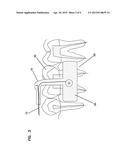 IONTOPHORETIC DEVICE AND A METHOD OF DELIVERY FOR DENTAL APPLICATIONS diagram and image