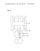 IONTOPHORETIC DEVICE AND A METHOD OF DELIVERY FOR DENTAL APPLICATIONS diagram and image