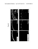 METHOD FOR SCREENING AMELIORANTS OF DRY SKIN CAUSED BY ATOPIC DERMATITIS     USING BLEOMYCIN HYDROLASE ACTIVITY AS INDICATOR diagram and image