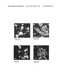 RETINAL PIGMENT EPITHELIAL CELLS DIFFERENTIATED FROM EMBRYONIC STEM CELLS     WITH NICOTINAMIDE AND ACTIVIN A diagram and image