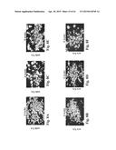 RETINAL PIGMENT EPITHELIAL CELLS DIFFERENTIATED FROM EMBRYONIC STEM CELLS     WITH NICOTINAMIDE AND ACTIVIN A diagram and image