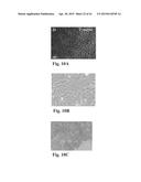 RETINAL PIGMENT EPITHELIAL CELLS DIFFERENTIATED FROM EMBRYONIC STEM CELLS     WITH NICOTINAMIDE AND ACTIVIN A diagram and image