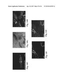 RETINAL PIGMENT EPITHELIAL CELLS DIFFERENTIATED FROM EMBRYONIC STEM CELLS     WITH NICOTINAMIDE AND ACTIVIN A diagram and image