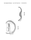 RETINAL PIGMENT EPITHELIAL CELLS DIFFERENTIATED FROM EMBRYONIC STEM CELLS     WITH NICOTINAMIDE AND ACTIVIN A diagram and image