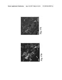 RETINAL PIGMENT EPITHELIAL CELLS DIFFERENTIATED FROM EMBRYONIC STEM CELLS     WITH NICOTINAMIDE AND ACTIVIN A diagram and image