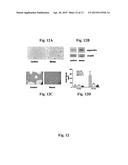ADMINISTRATION OF ANGIOCIDIN FOR THE TREATMENT OF CANCER diagram and image