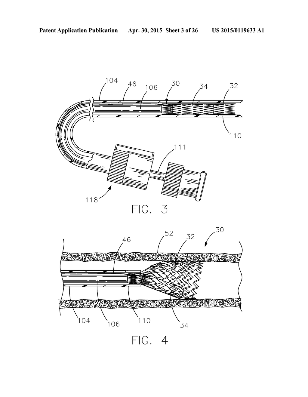 INTRAVASCULAR DEVICE ATTACHMENT SYSTEM HAVING BIOLOGICAL MATERIAL - diagram, schematic, and image 04