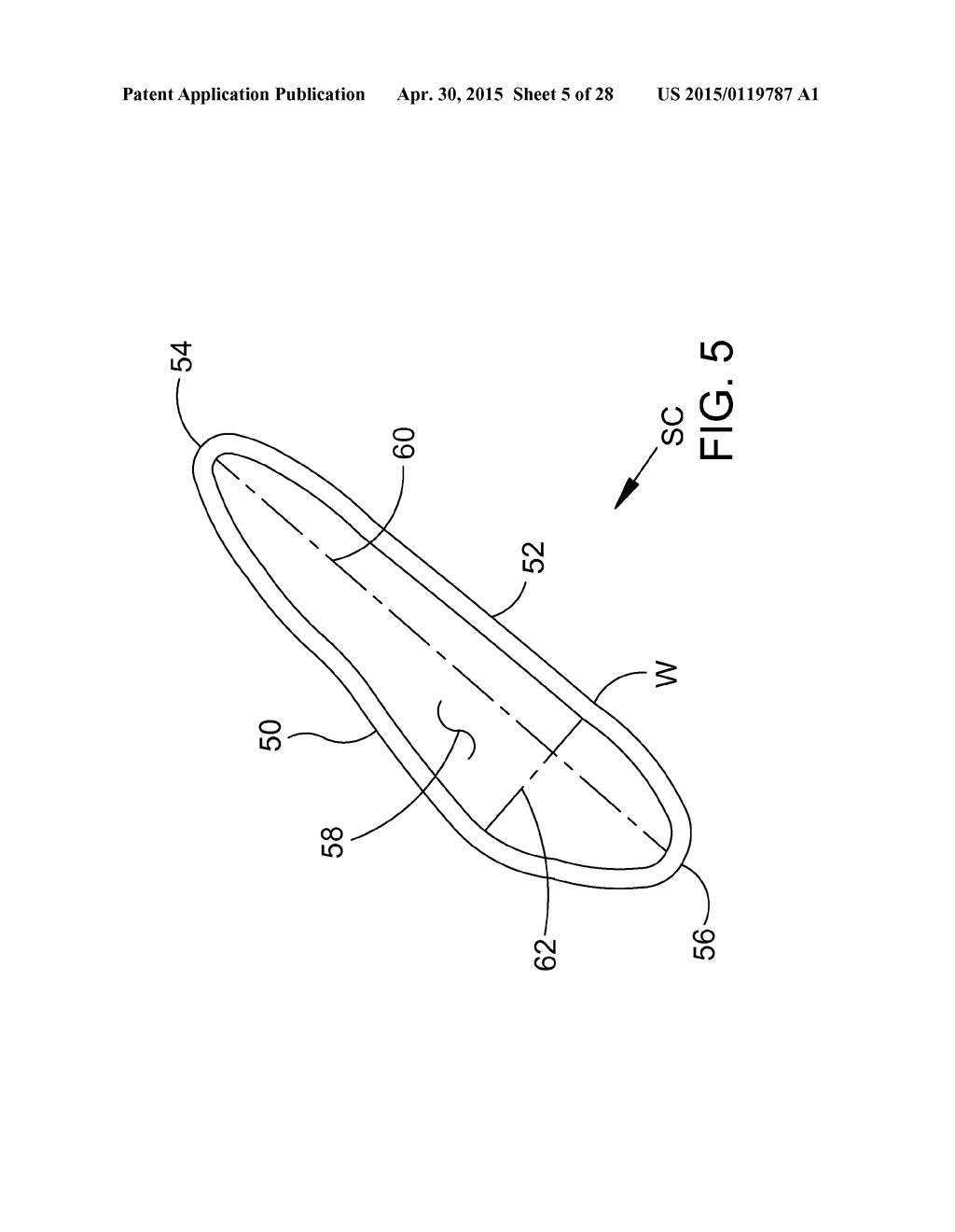 DELIVERING OCULAR IMPLANTS INTO THE EYE - diagram, schematic, and image 06