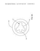 DELIVERING OCULAR IMPLANTS INTO THE EYE diagram and image