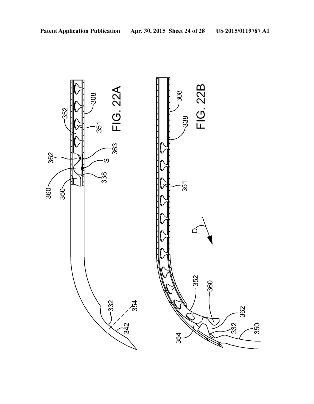 DELIVERING OCULAR IMPLANTS INTO THE EYE - diagram, schematic, and image 25