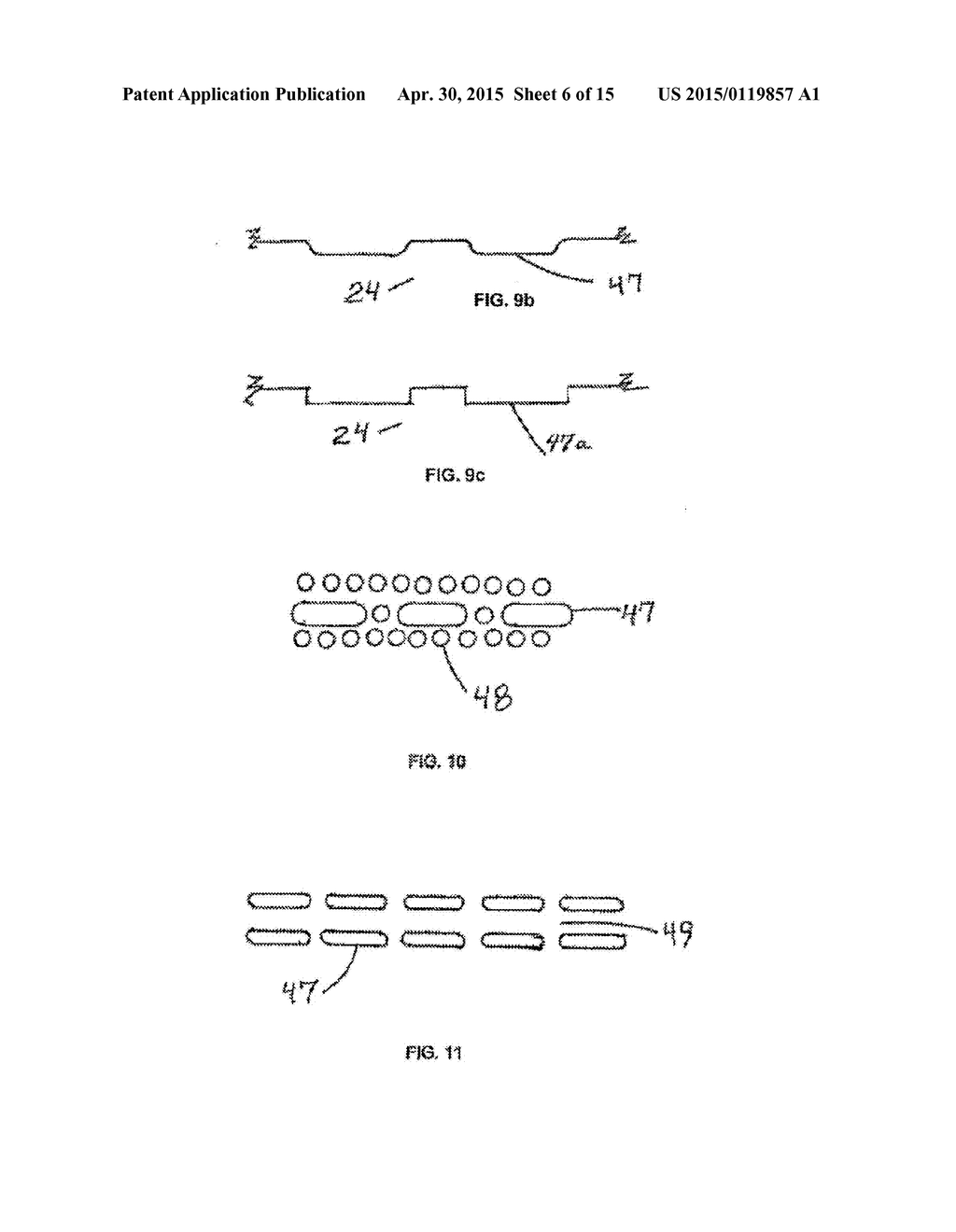 WOUND TREATMENT DEVICE EMPLOYING NEGATIVE PRESSURE - diagram, schematic, and image 07